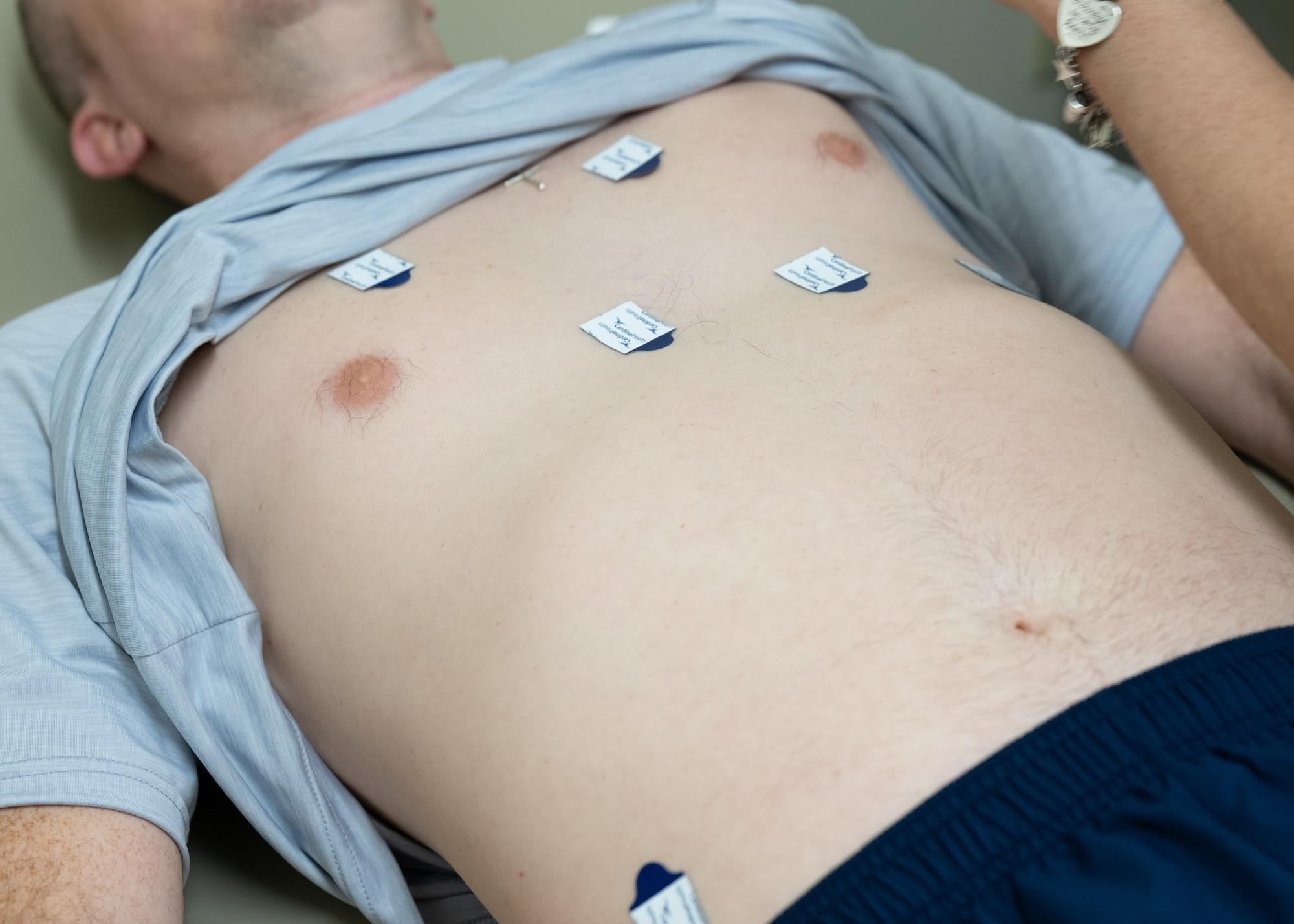 An Air Force basic trainee undergoes electrocardiogram preparation during an ERASE cardiac screening at Joint Base San Antonio-Lackland, Texas, March 22, 2025. U.S. Air Force photo by Senior Airman Matthew-John Braman.
