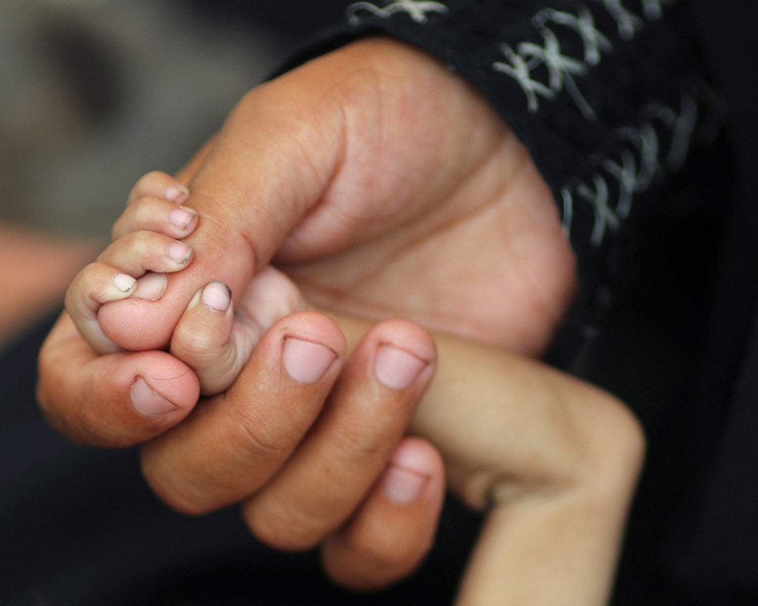 Nearly 12,000 children under five in Gaza have acute malnutrition, says WHO