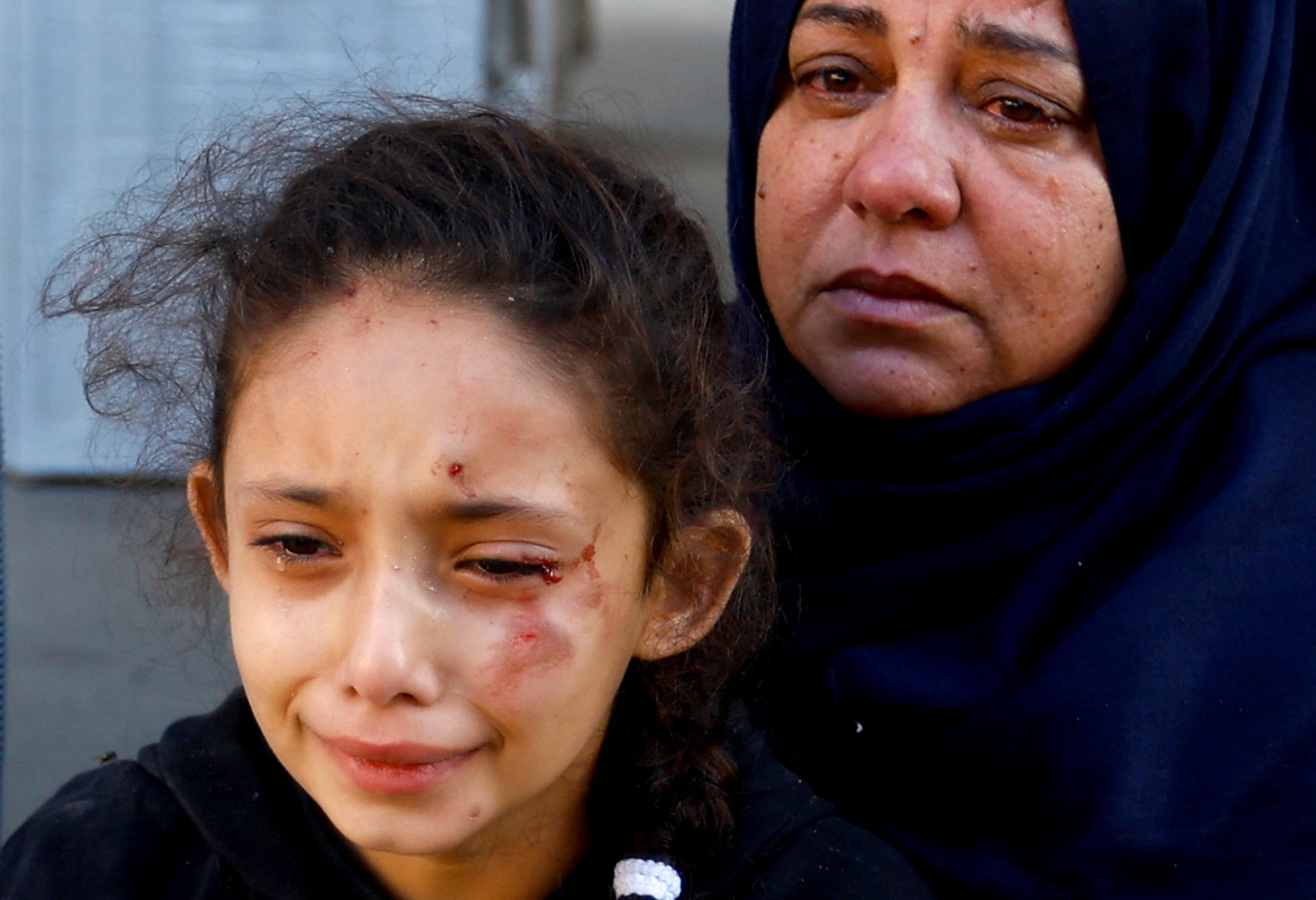 447 children and 248 women among 1,417 killed in Israeli strikes in Gaza