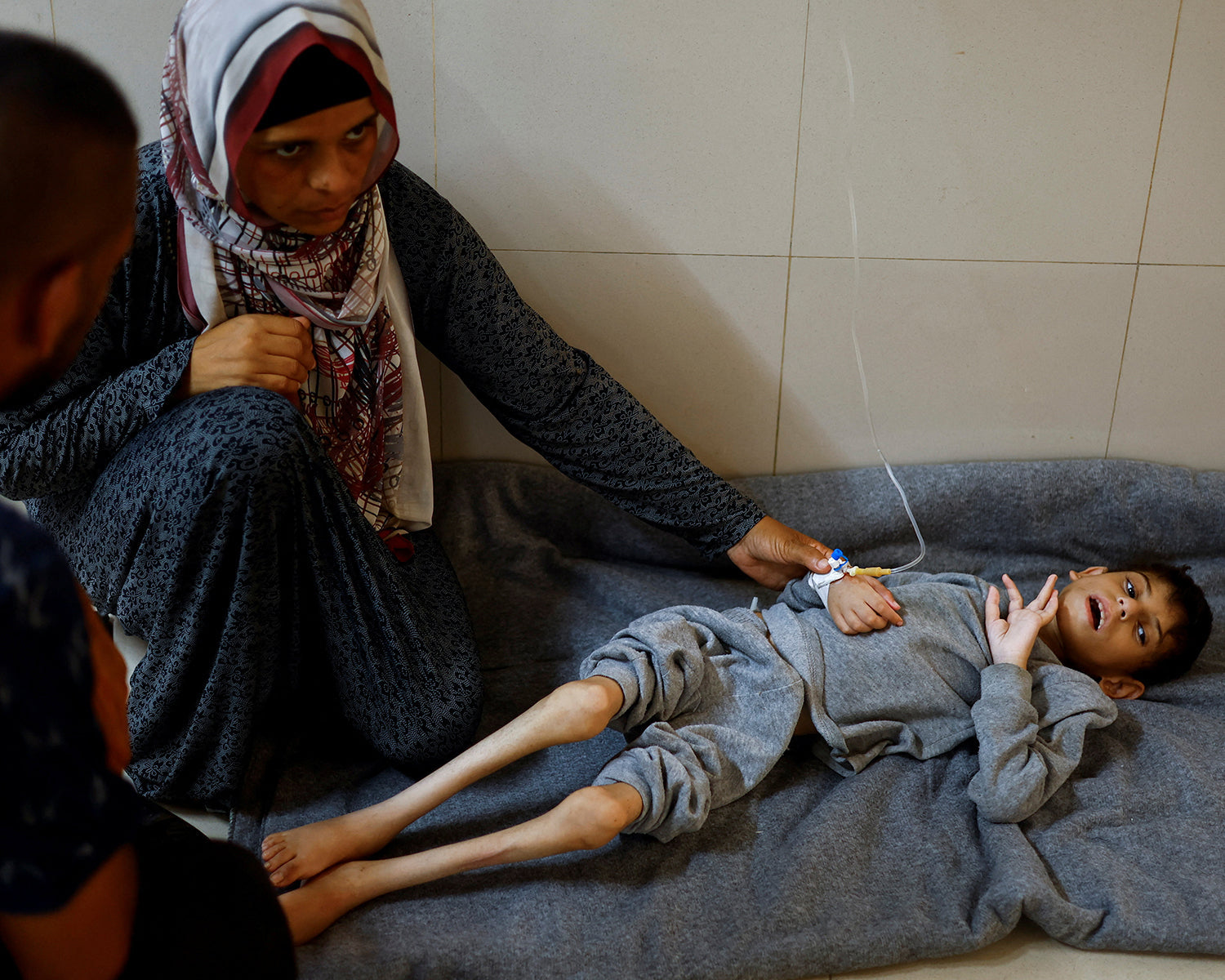 Gaza running out of specialized food to save malnourished children amid Israeli blockade