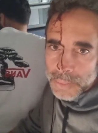A bloodied passenger aboard flydubai Flight FZ1073 records video from inside the aircraft following the Sept. 30 cockpit incident. The flight made an emergency landing in Tabuk, Saudi Arabia.