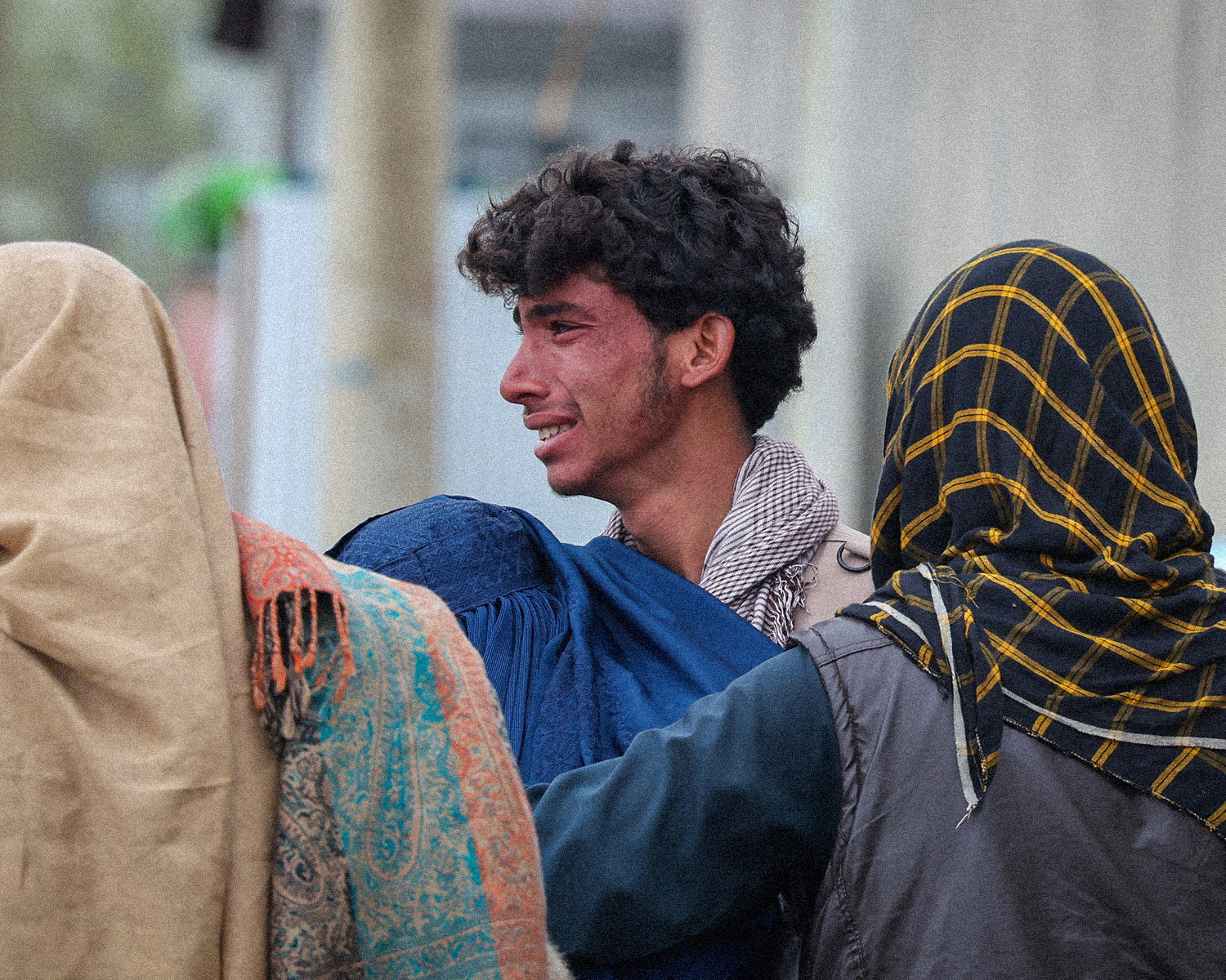 UN mission puts death toll at 143 in Kabul rehab center bombing by Pakistan